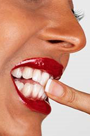 home-teeth-whitening Holley Dental Zoom! Whitening