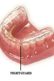 nightguardbruxism Crux of Bruxism